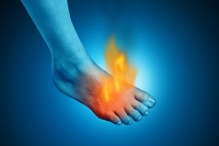 Burning Feet and How a Podiatrist Can Help