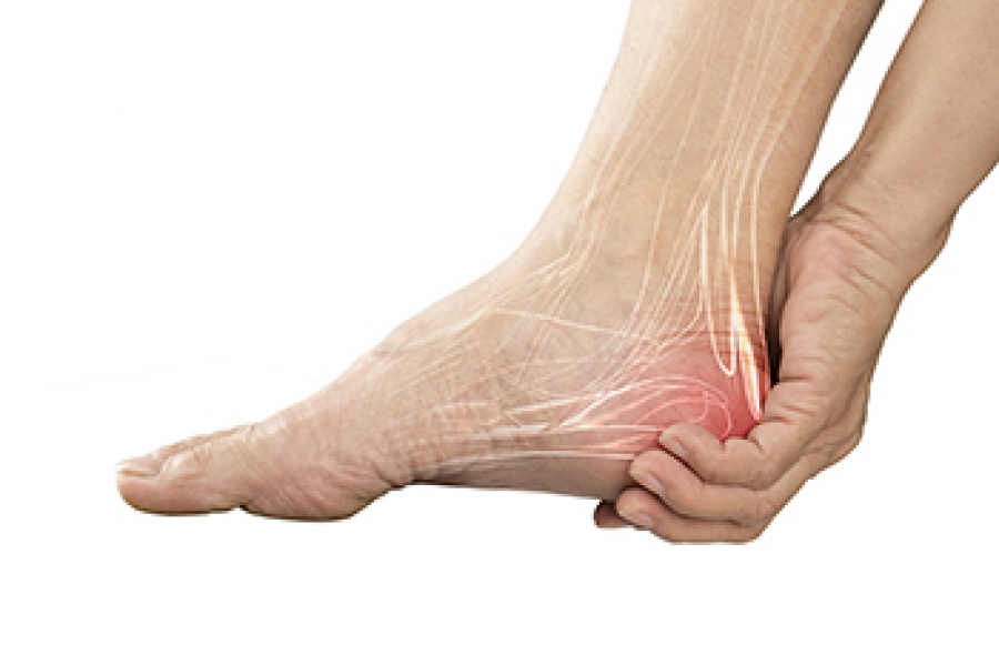Rheumatoid Arthritis in the Feet — Dr. James Ricketti & Associates
