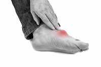 Definition and Early Signs of Gout