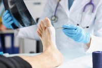 Decisions About Foot Surgery
