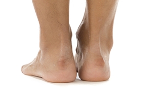 What Is This Painful Bump at the Back of My Heel?