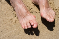 Dealing With a Hammertoe