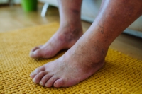Essential Diabetic Foot Care